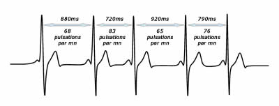 cohérence cardiaque